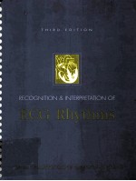 Recognition & interpretation of ECG rhythms