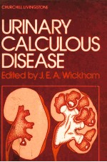 Urinary Calculous Disease