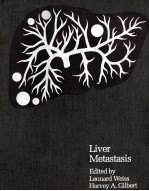 Liver metastasis