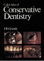 Color atlas of conservative dentistry