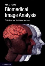 BIOMEDICAL IMAGE ANALYSIS STATISTICAL AND VARIATIONAL METHODS