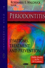 PERIODONTITIS SYMPTOMS