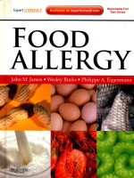 FOOD ALLERGY