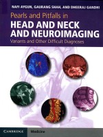 PEARLS AND PITFALLS IN HEAD AND NECK AND NEUROIMAGING VARIANTS AND OTHER DIFFICULT DIAGNOSES