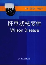 肝豆状核变性 Wilson 病