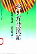毫针疗法图解 贺氏针灸三通法之二