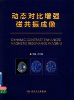 动态对比增强磁共振成像