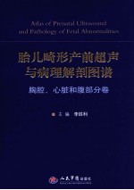 胎儿畸形产前超声与病理解剖图谱 胸腔、心脏和腹部分卷