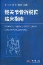 髋关节骨折脱位临床指南