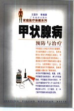 甲状腺病预防与治疗