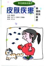 皮肤疾患 癣 湿疹 皮炎 痣 疣