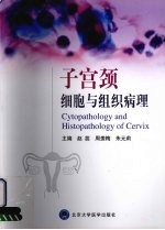 子宫颈细胞与组织病理