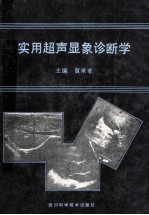 实用超声显象诊断学