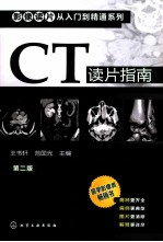 CT读片指南 第2版