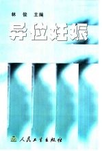 异位妊娠