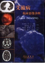艾滋病临床影像诊断