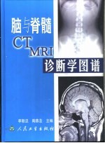 脑与脊髓CT、MRI诊断学图谱