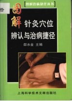 图解针灸穴位辨认与治病捷径