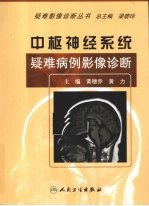 中枢神经系统疑难病例影像诊断