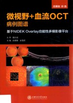 微视野+血流OCT病例图谱 基于NIDEK Overlay功能性多模影像平台
