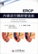 内镜逆行胰胆管造影ERCP