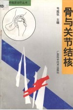 骨与关节结核