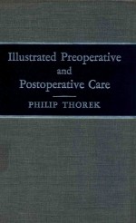 ILLUSTRATED PREOPERATIVE AND POSTOPERATIVE CARE