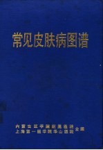 常见皮肤病图谱