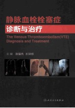 静脉血栓栓塞症诊断与治疗
