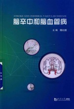 脑卒中和脑血管病