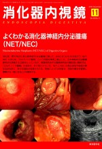 消化器内视镜 第28卷 第11号