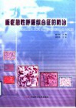 重症急性呼吸综合征的防治