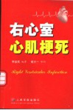 右心室心肌梗死