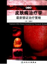 皮肤病治疗学 最新循证治疗策略
