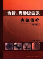 食管、胃静脉曲张内镜治疗