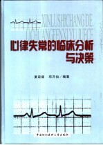 心律失常的临床分析与决策