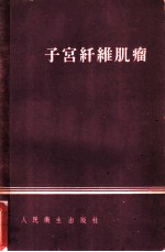 子宫纤维肌瘤