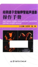 经阴道子宫输卵管超声造影操作手册