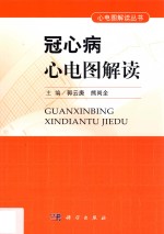 冠心病心电图解读