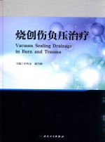 烧创伤负压治疗