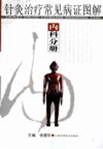 针灸治疗常见病证图解 内科分册