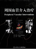 周围血管介入治疗 翻译版