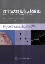 遗传性大疱性表皮松解症病因诊断多学科护理及治疗