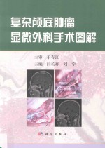 复杂颅底肿瘤显微外科手术图解