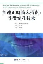 加速正畸临床指南 骨微穿孔技术