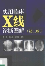 实用临床X线诊断图解 第2版
