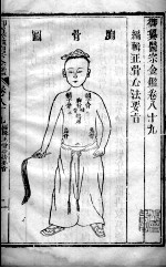 医宗金鉴 卷89-90