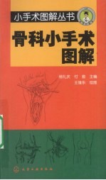 骨科小手术图解