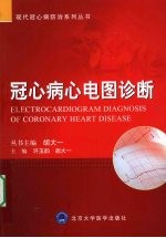 冠心病心电图诊断