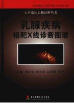乳腺疾病锄靶X线诊断图谱